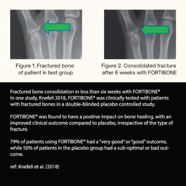 Osteo Boost Collagen