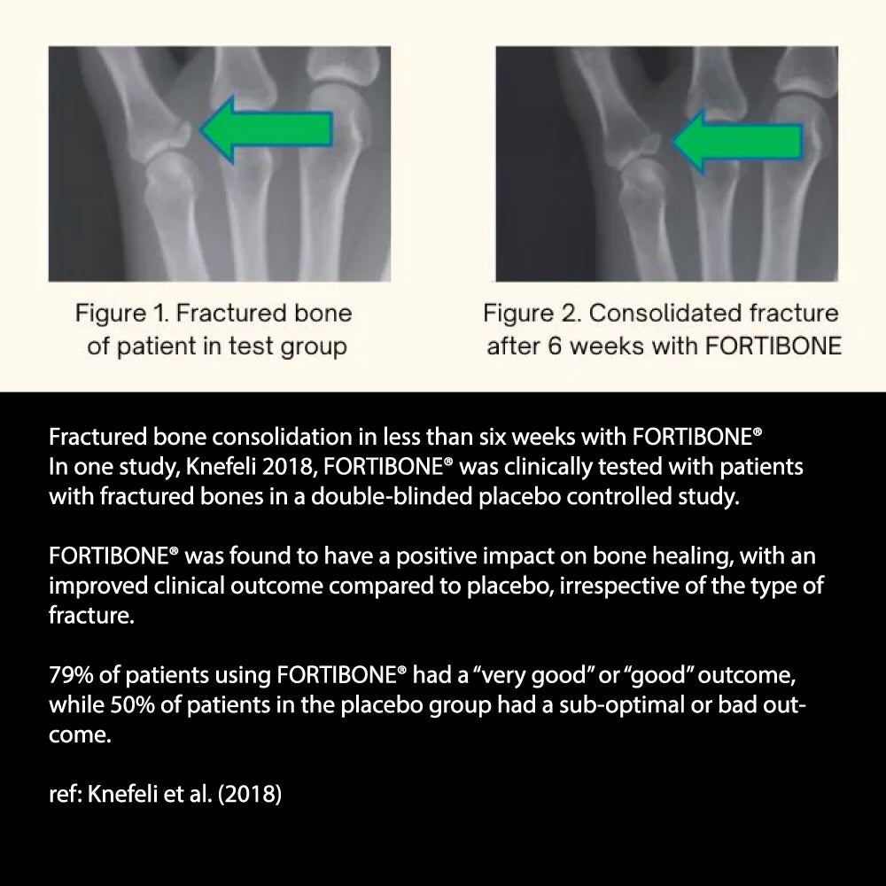 Bone and Joint Bundle